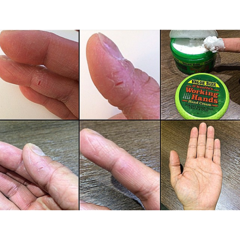 O’Keeffe’s Working Hands Cream Spezielle Formel American Gorilla Glue